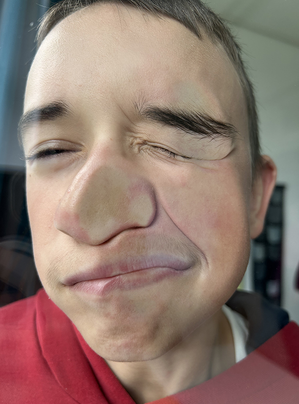 Gesicht an die Fensterscheibe gepresst